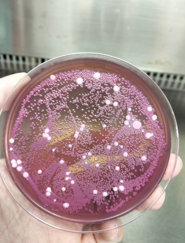 Pesquisa identifica leveduras com potencial para indústria do etanol e da cerveja